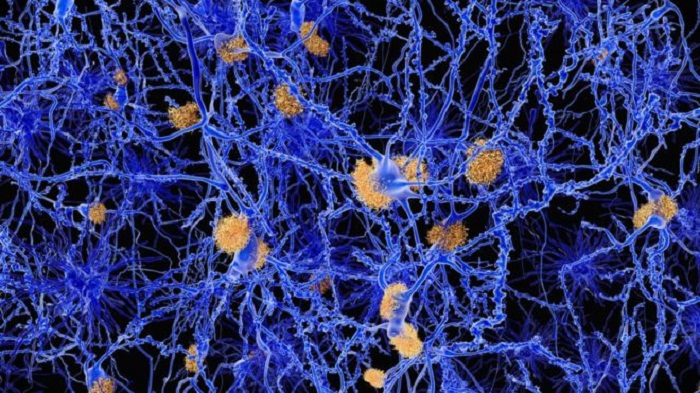 Molecule clears Alzheimer`s plaques in mice